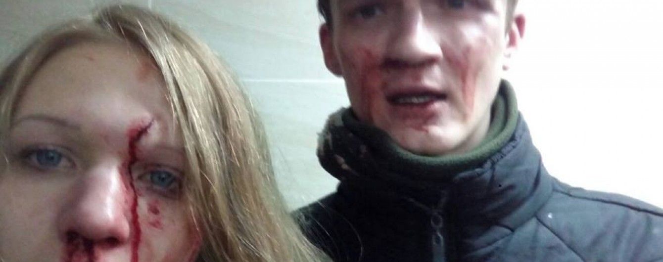 Віта Заверуха та її хлопець звинуватили націоналістів у кривавому побитті