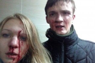 Віта Заверуха та її хлопець звинуватили націоналістів у кривавому побитті