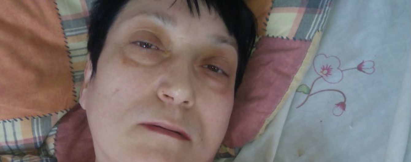 Допомоги в боротьби з раком шлунка потребує Людмила