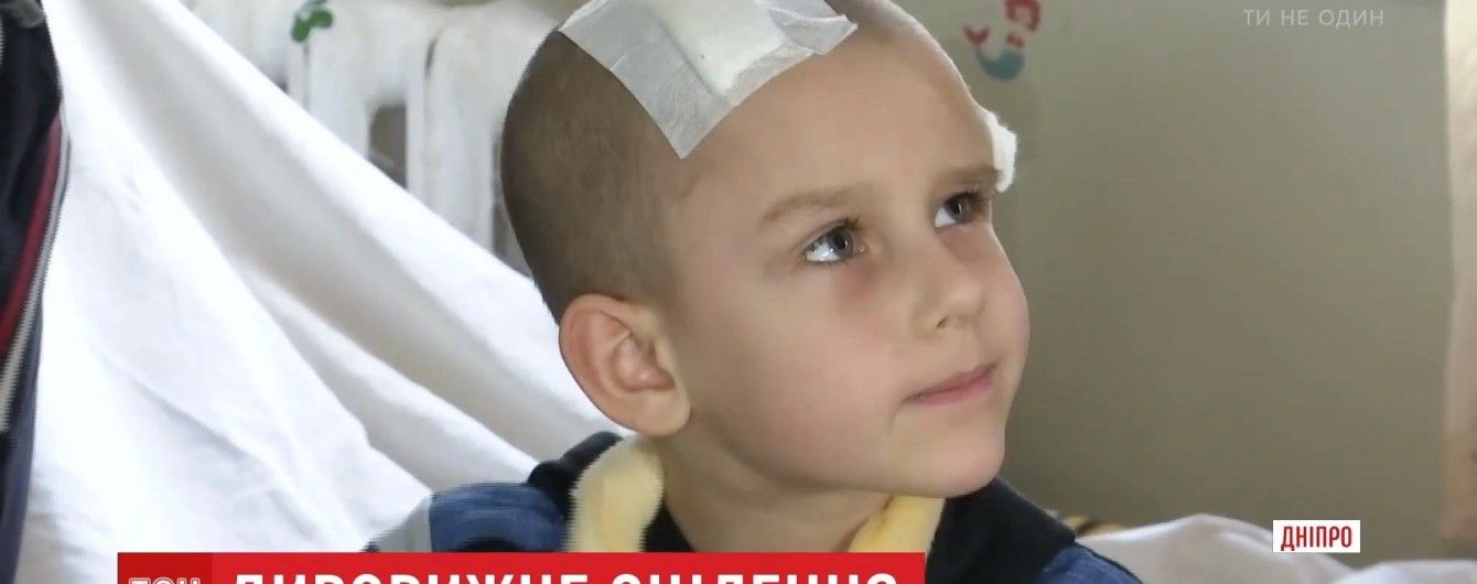 Маленький хлопчик здивував оточення одужанням після наскрізного поранення черепу й мозку