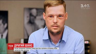 Американські хірурги провели надскладну операцію з пересадки обличчя