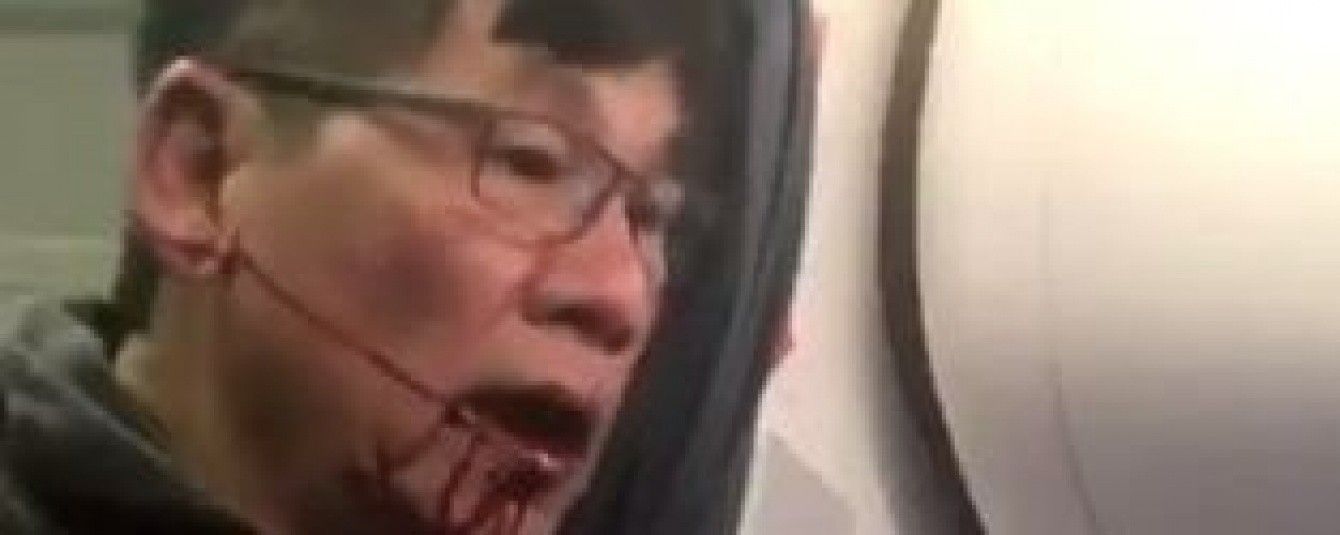 Скандал вокруг авиакомпании United: пассажира-азиата силой вытащили из самолета, разбив губу