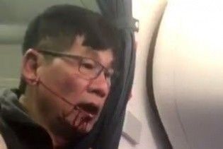 Скандал вокруг авиакомпании United: пассажира-азиата силой вытащили из самолета, разбив губу
