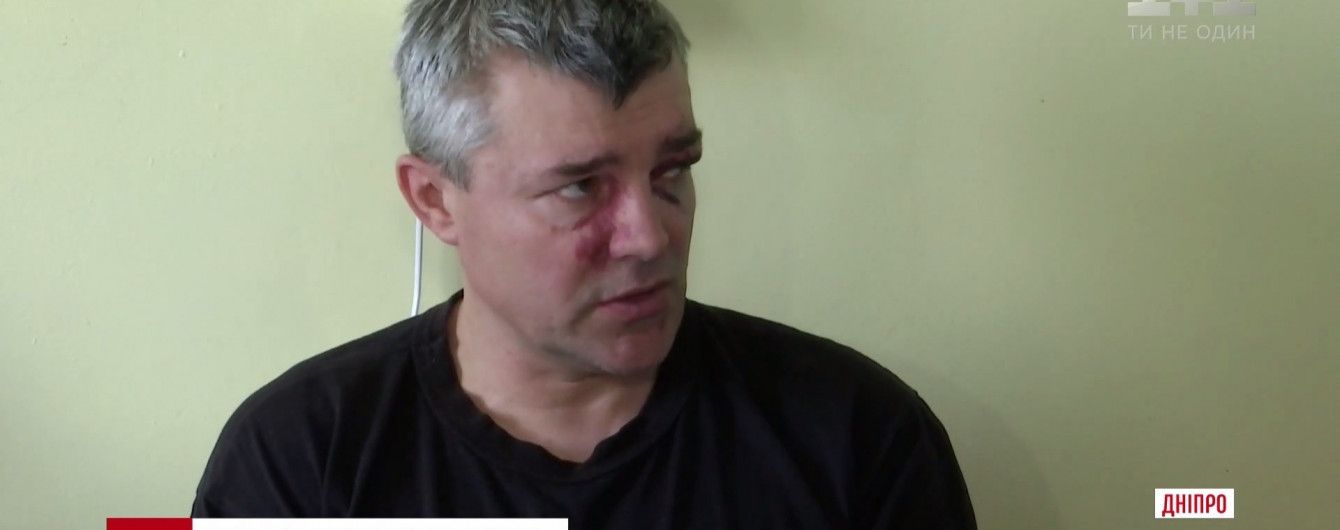 Пострадавший 9 мая в Днепре АТОшник лежит в больнице с ЧМТ и переломом носа