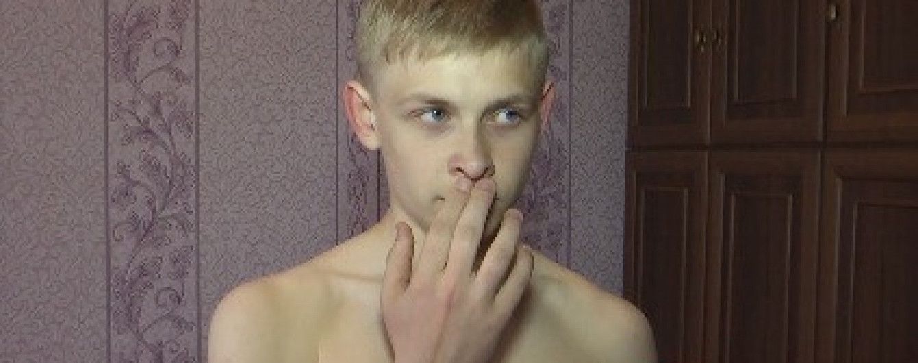 На Ровенщине мужчина кулаками избил 12-летнего мальчика, потому что решил, что тот обидел его сына