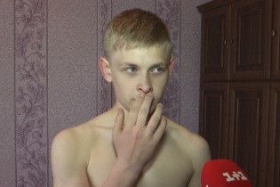 На Ровенщине мужчина кулаками избил 12-летнего мальчика, потому что решил, что тот обидел его сына