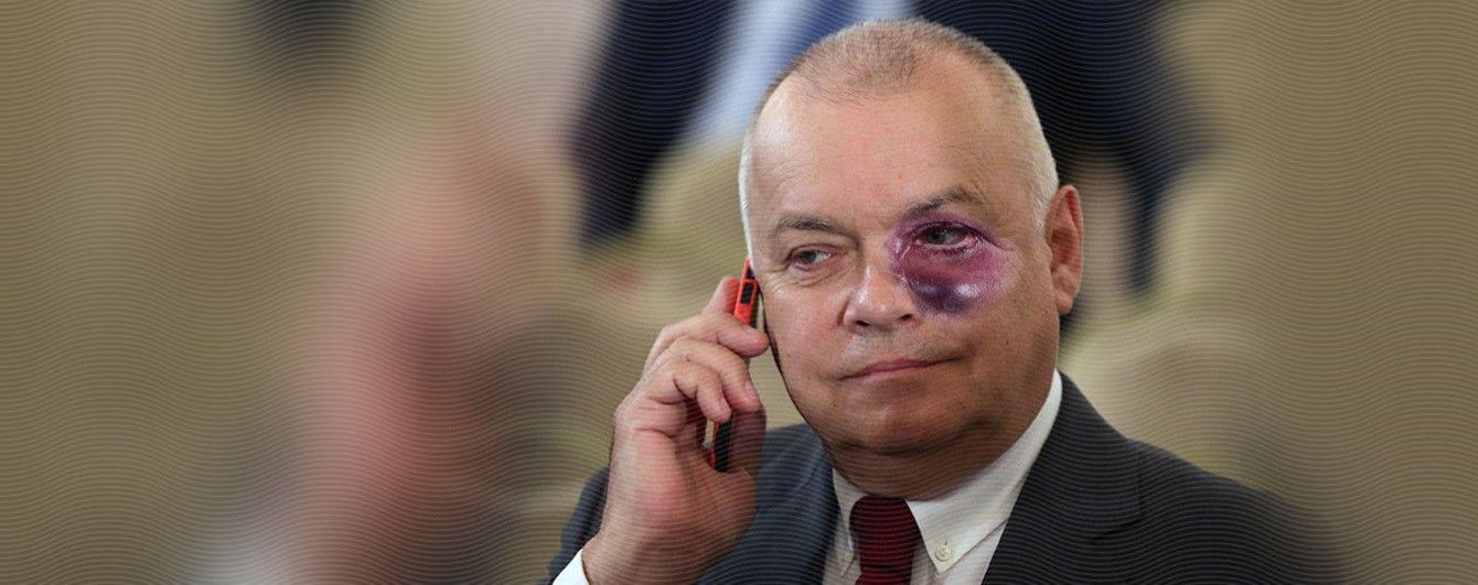 Шутки про Киселева с разбитым лицом и песня O.Torvald на языке жестов. Тренды Сети