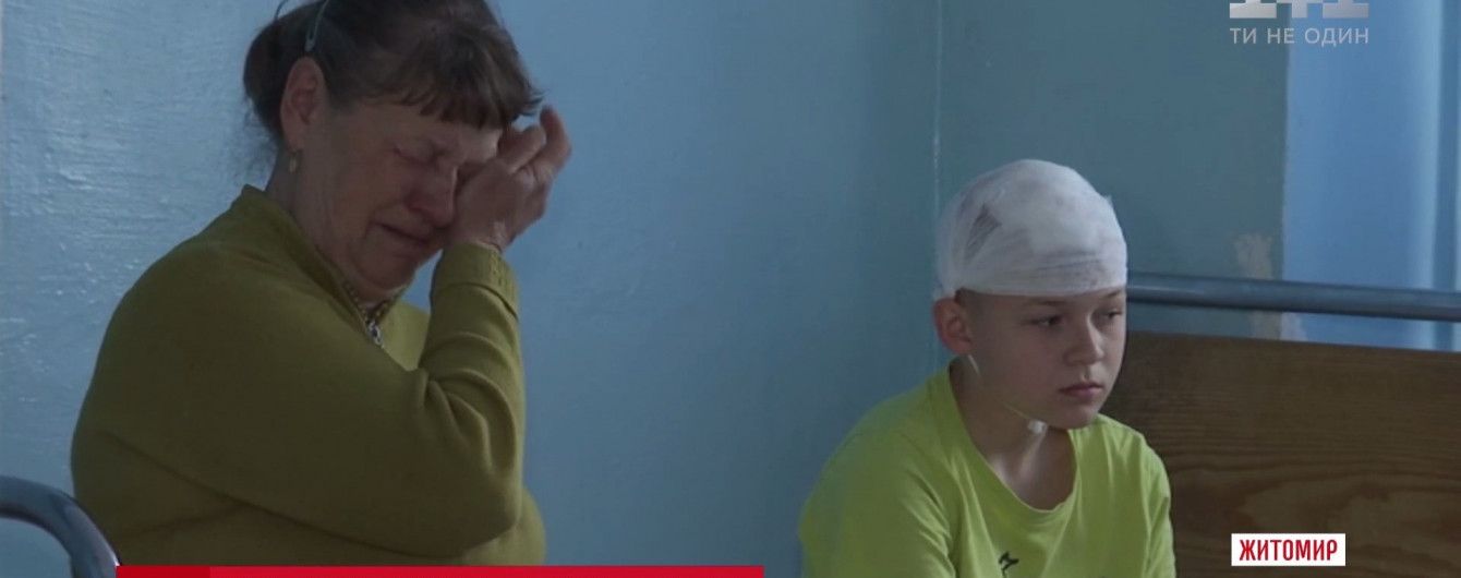 В Житомире троллейбусная штанга "отправила" школьника в больницу