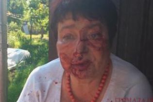 На Киевщине на заказ жестоко избили председателя ТИК Коцюбинского