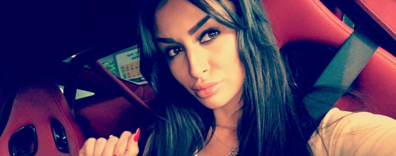 Британська топ-модель розповіла, як важка хвороба назавжди перервала її кар'єру
