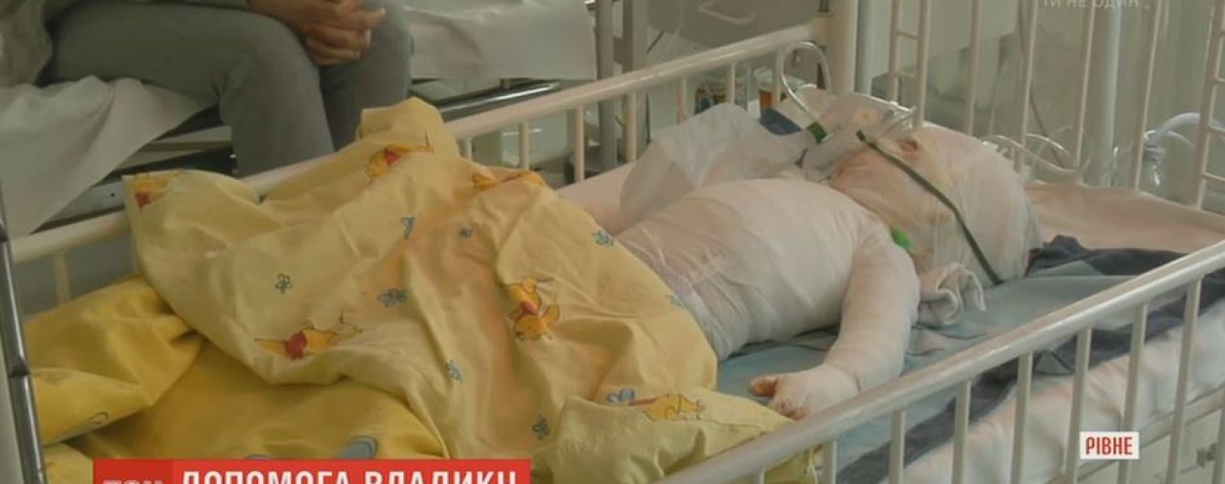 Украинцы собрали средства для спасения обгоревшего полуторагодовалого Влада