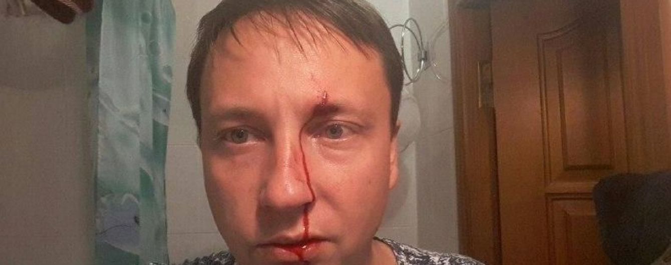 На Одесчине избили депутата горсовета в его день рождения