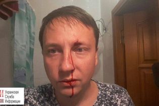 На Одесчине избили депутата горсовета в его день рождения