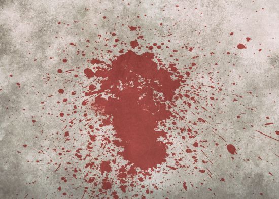 На Луганщині невідомі порізали бойовика "ЛНР" - розвідка