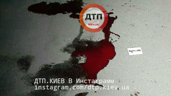 У Києві невідомий порізав молоду дівчину ножем