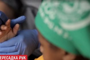 Американські хірурги пересадили дитині обидві руки, які ростимуть разом із пацієнтом