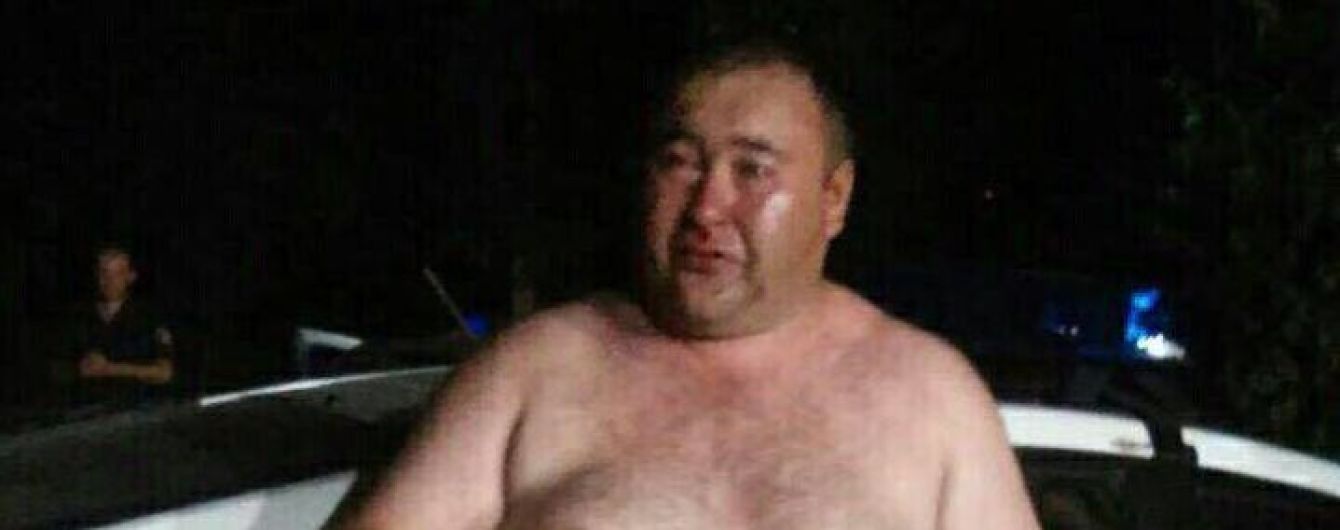 У Кривому Розі керівник із поліції напідпитку влаштував бійку біля кафе та матюкався