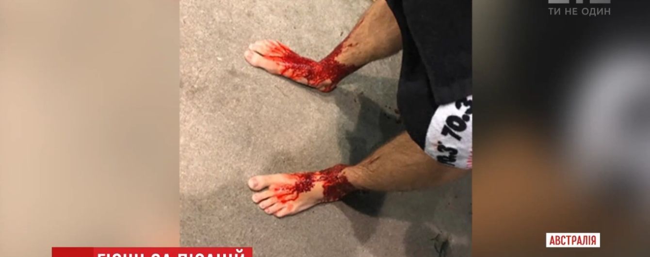 В Австралии неизвестные морские существа превратили ноги юноши в кровавое месиво