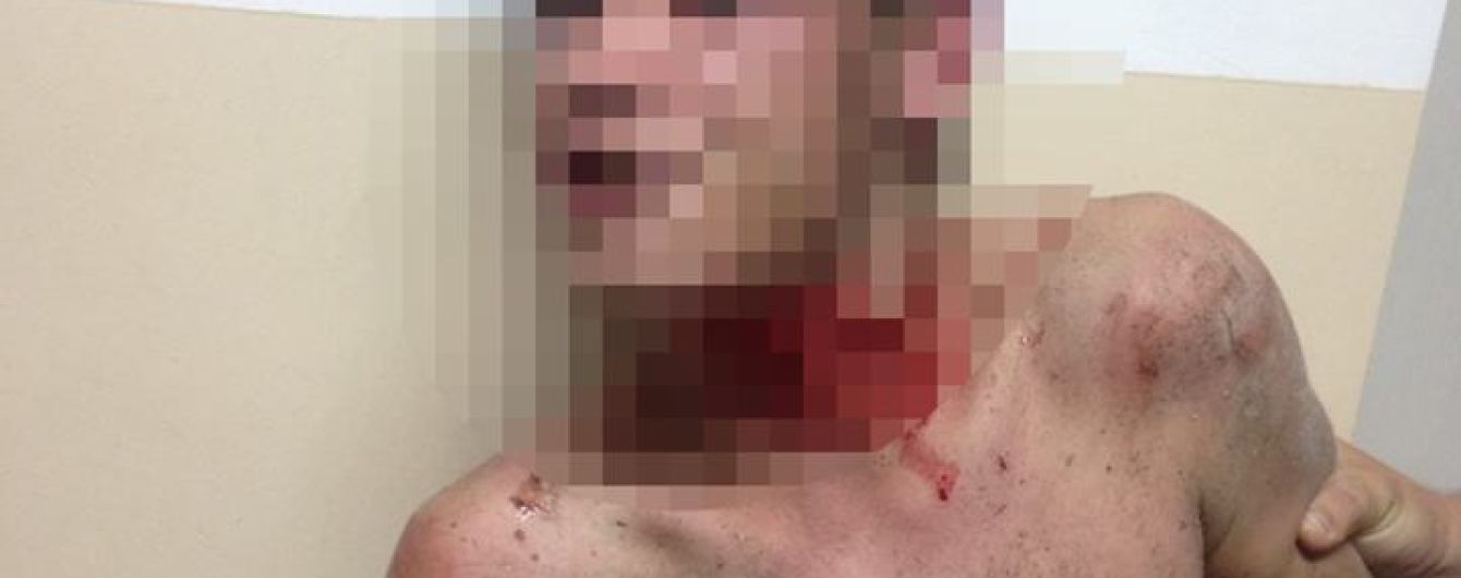 У Житомирі чоловік кидався у перехожих камінням і намагався перерізати собі горло