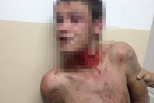У Житомирі чоловік кидався у перехожих камінням і намагався перерізати собі горло
