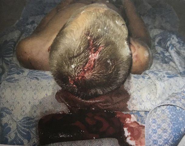 Прокуратура повідомила про підозру меру Ірпеня