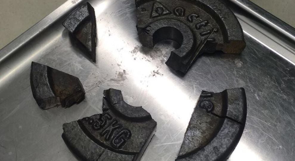 У Німеччині спеціалісти три години рятували пеніс з отвору диска для гантелі