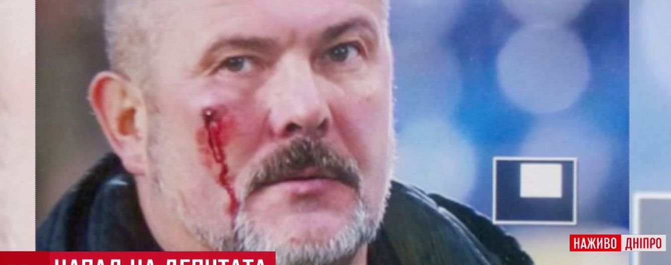 Драка с нардепом Березой на стадионе в Днепре: все подробности и версии сторон