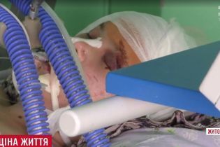Сельские подростки на Житомирщине забили почти до смерти 17-летнюю девушку за 500 гривен