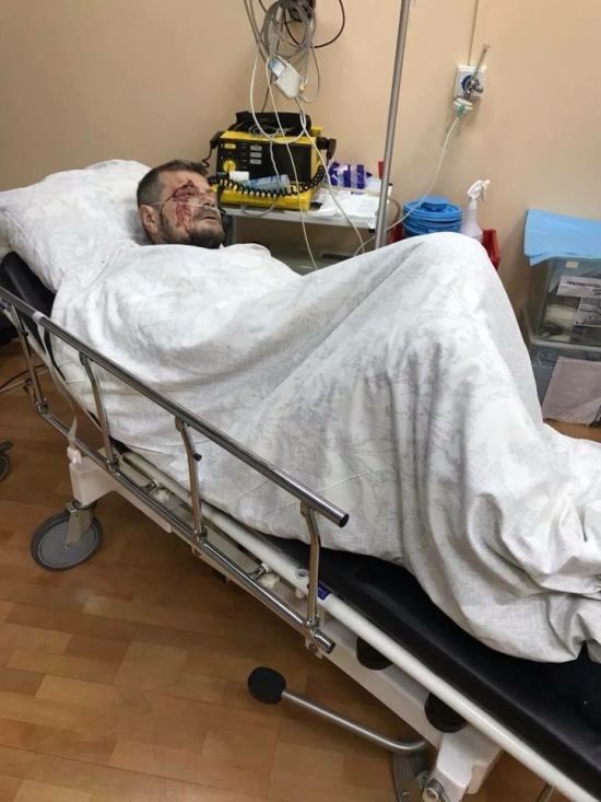 Постраждалого під час теракту у Києві Мосійчука перевели до іншої лікарні