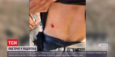 У Миколаєві чоловік вдарив скейтбордиста, а потім влучив хлопцю в спину з пневматичної зброї