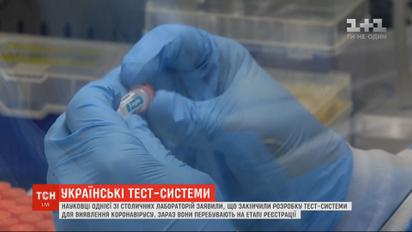 Украинские тест-системы для выявления коронавируса готовы – ученые лаборатории в Киеве