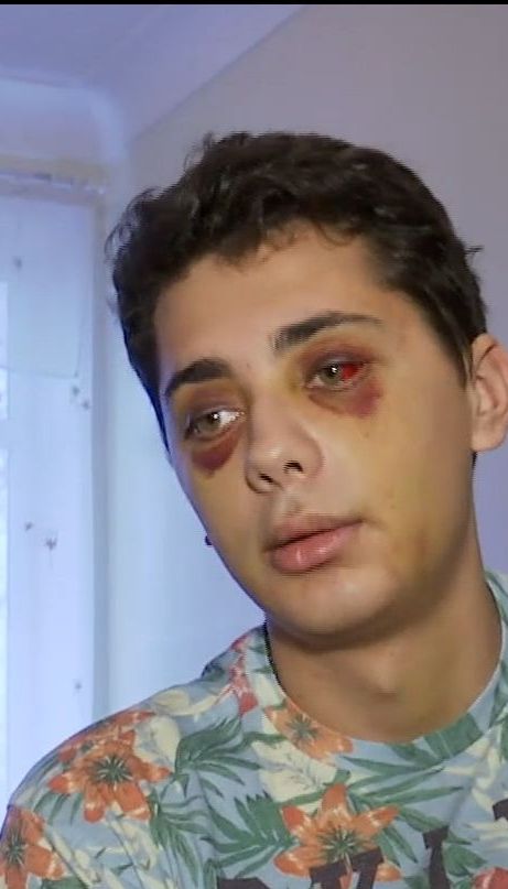 У Сумах охоронці нічного клубу побили клієнта