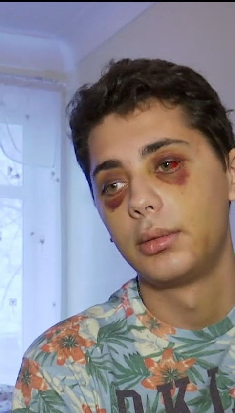В Сумах охранники ночного клуба избили клиента