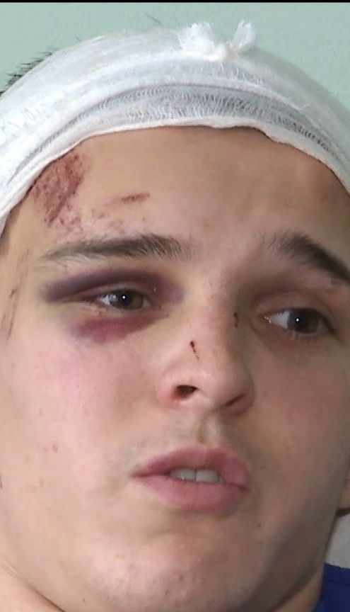 У Глевасі студента жорстоко побили школярі