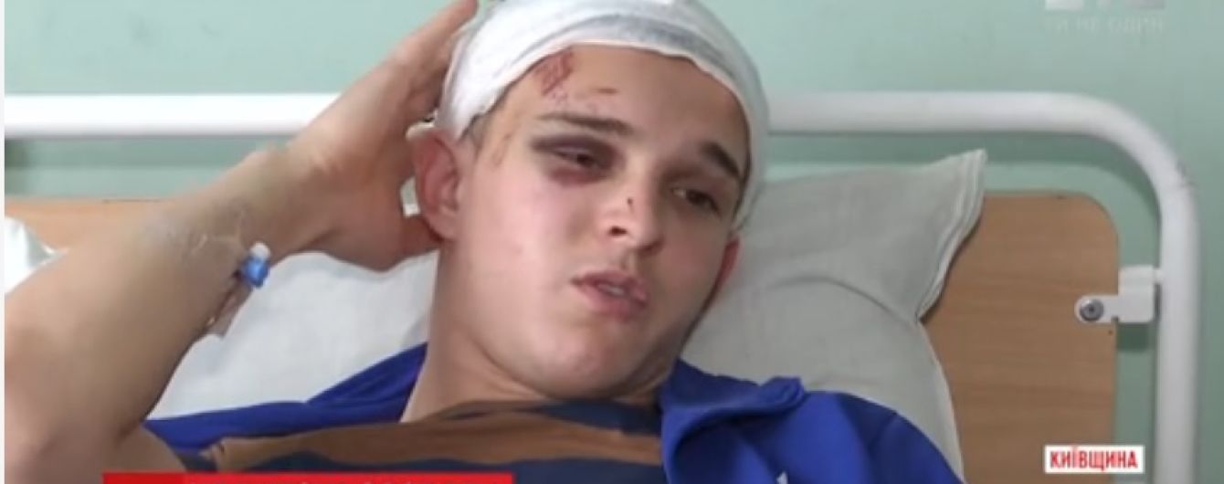 Діти-звірі. У Глевасі зграя підлітків заради розваги ледве не вбила студента
