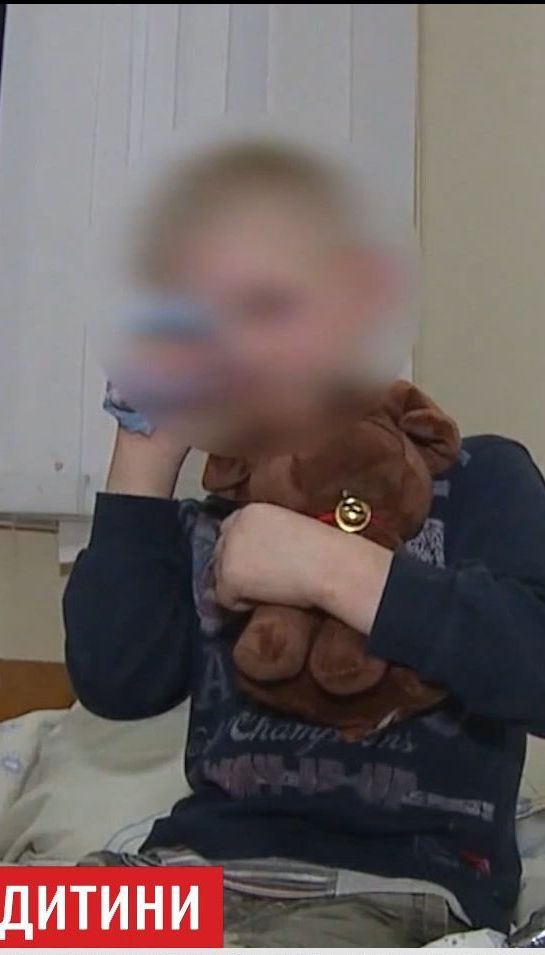 В Виннице мать избила ребенка в кровь из-за опрокинутого борща