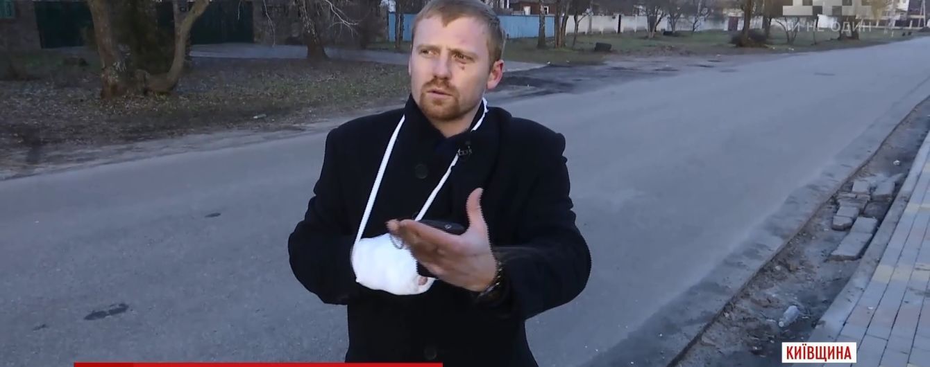 Стан побитих на свята хуліганами в Глевасі людей погіршився