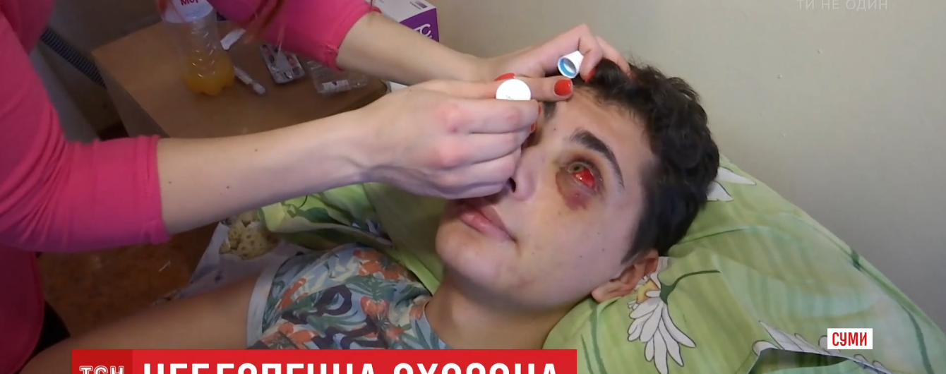 Скандальный ночной клуб в Сумах. Полиция расследует несколько дел об избиении клиентов