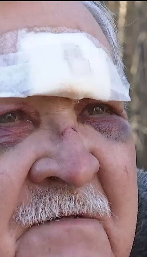 Зловмисники вдерлись до будинку та побили екс-полковника міліції на Київщині