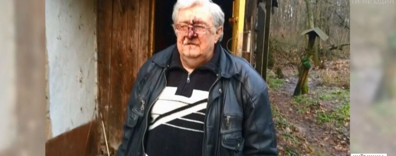 На Киевщине родственники жестоко избили полковника милиции и заснули на месте преступления