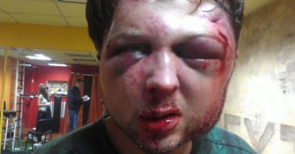 Избитые мужчины картинки