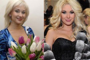 Катя Бужинська зізналась, які ін'єкції допомагають їй чарівно виглядати