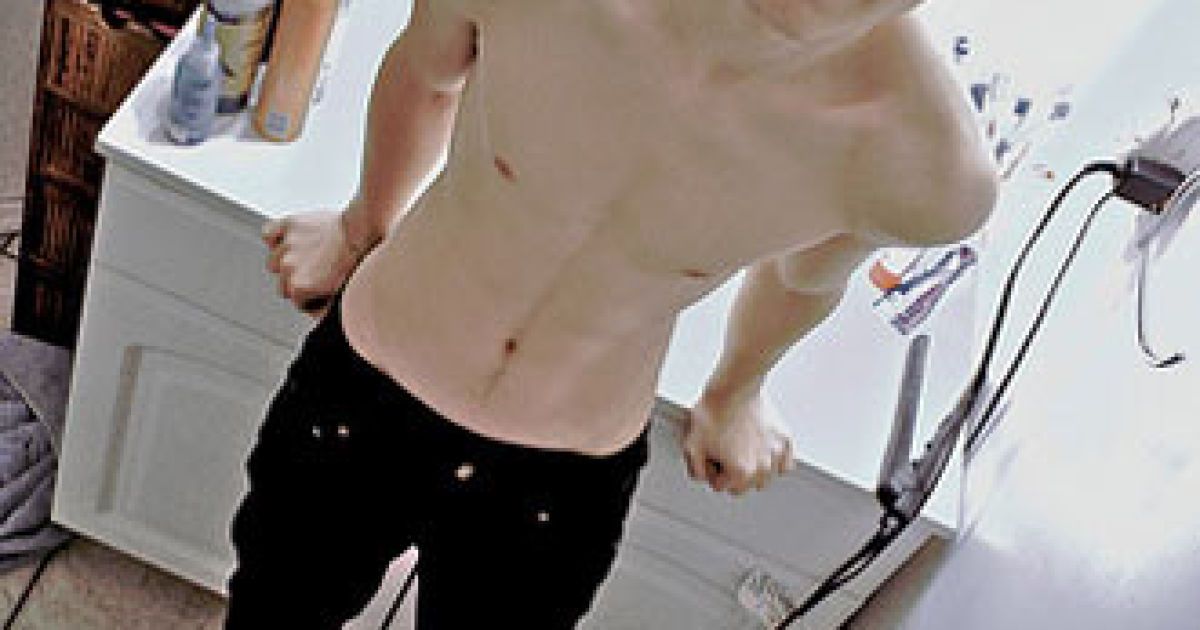 Anorexia gay man