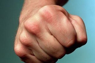 Неизвестный жестоко избил в подъезде дома одесскую активистку