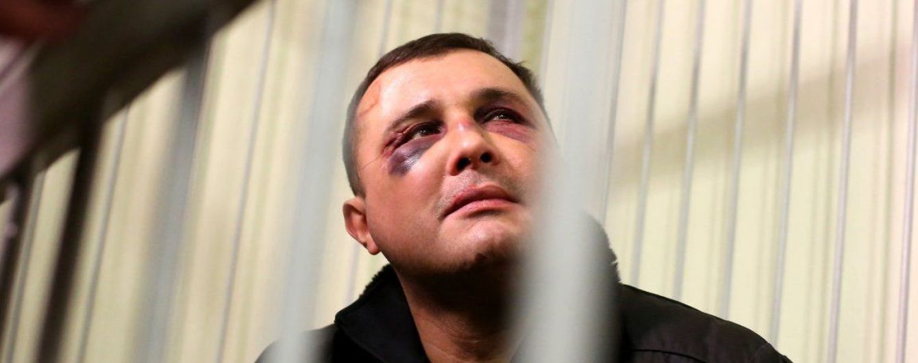 "Мішок на голову, в машину": екс-нардеп Шепелєв розповів, як його викрали і вибивали дані про олігархів