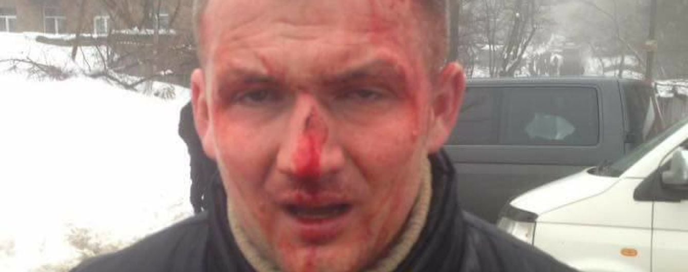 У Києві невідомі жорстоко побили нардепа-свободівця