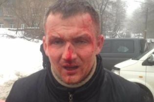 У Києві невідомі жорстоко побили нардепа-свободівця