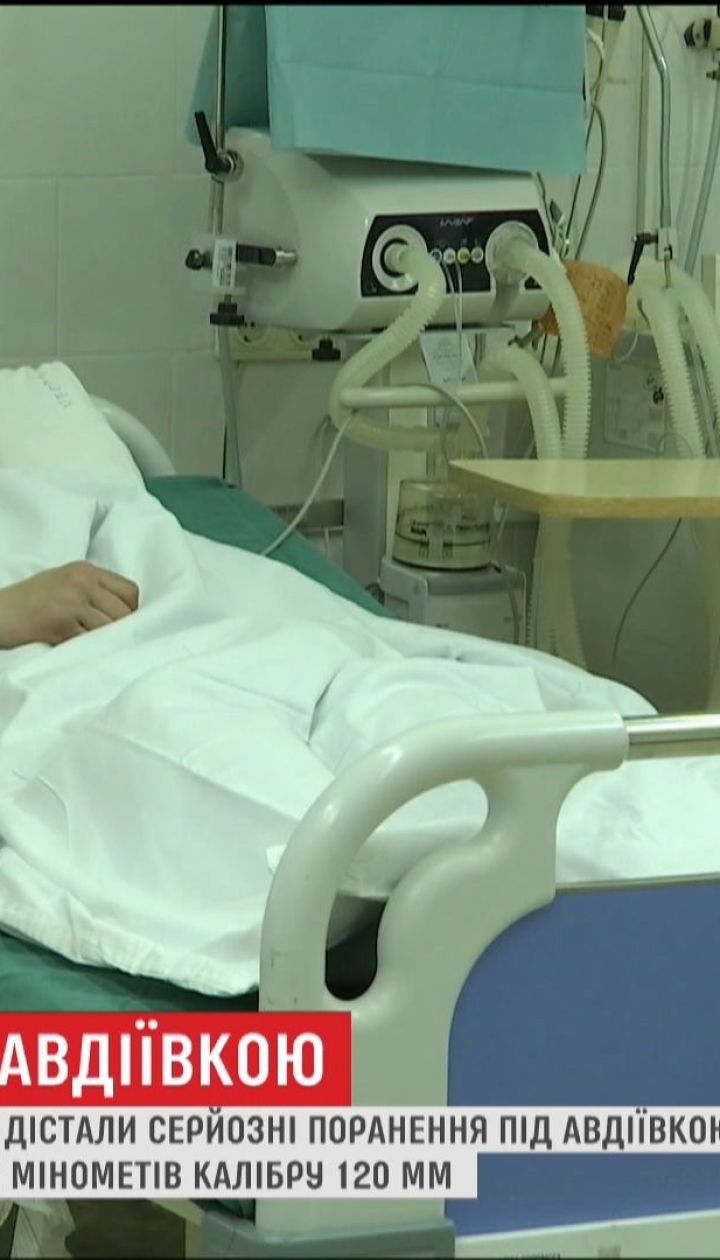 Ворожий снаряд зачепив двох українських бійців під Авдіївкою