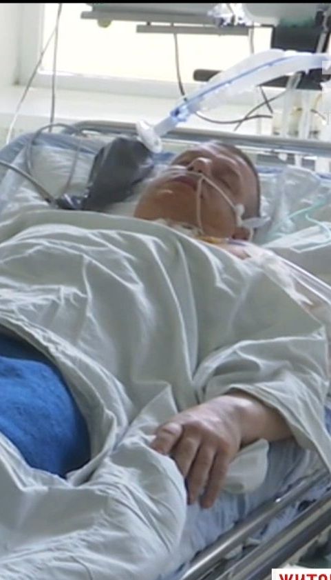 На Житомирщині депутат дивом вижив після обстрілу невідомим чоловіком