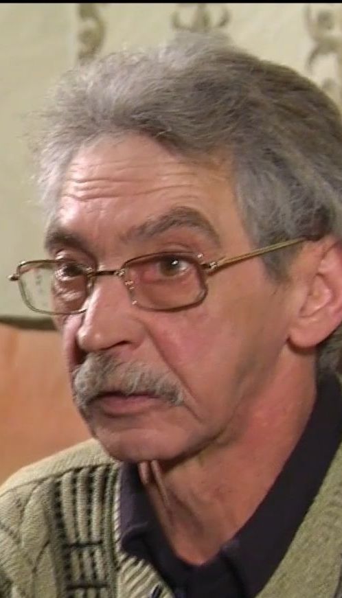 Житель Кривого Рога после операции в больнице три года страдал из-за забытого в носу бинта